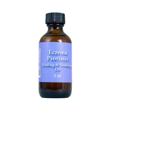 Eczema/Psoriasis Oil - 2oz.